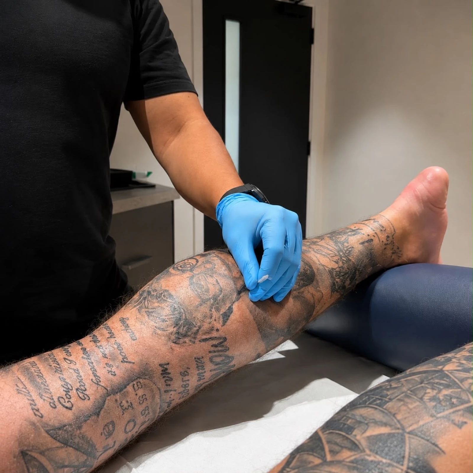 Dry needling applied to the lower leg at Full Motion Physio Manchester